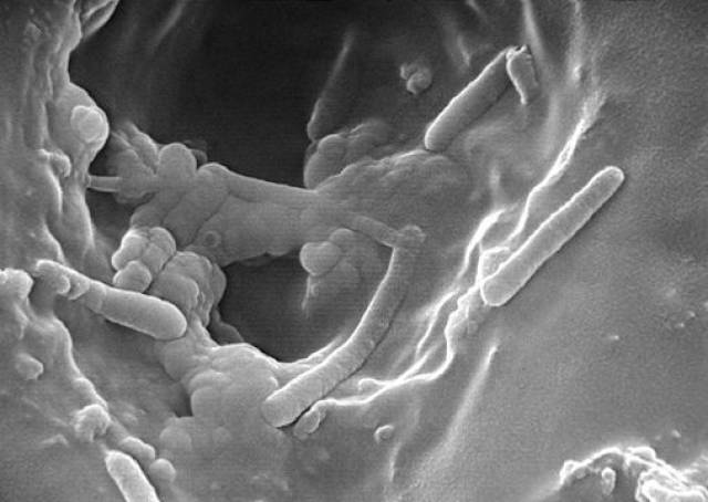 pseudomonas